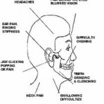 TMJ Treatment